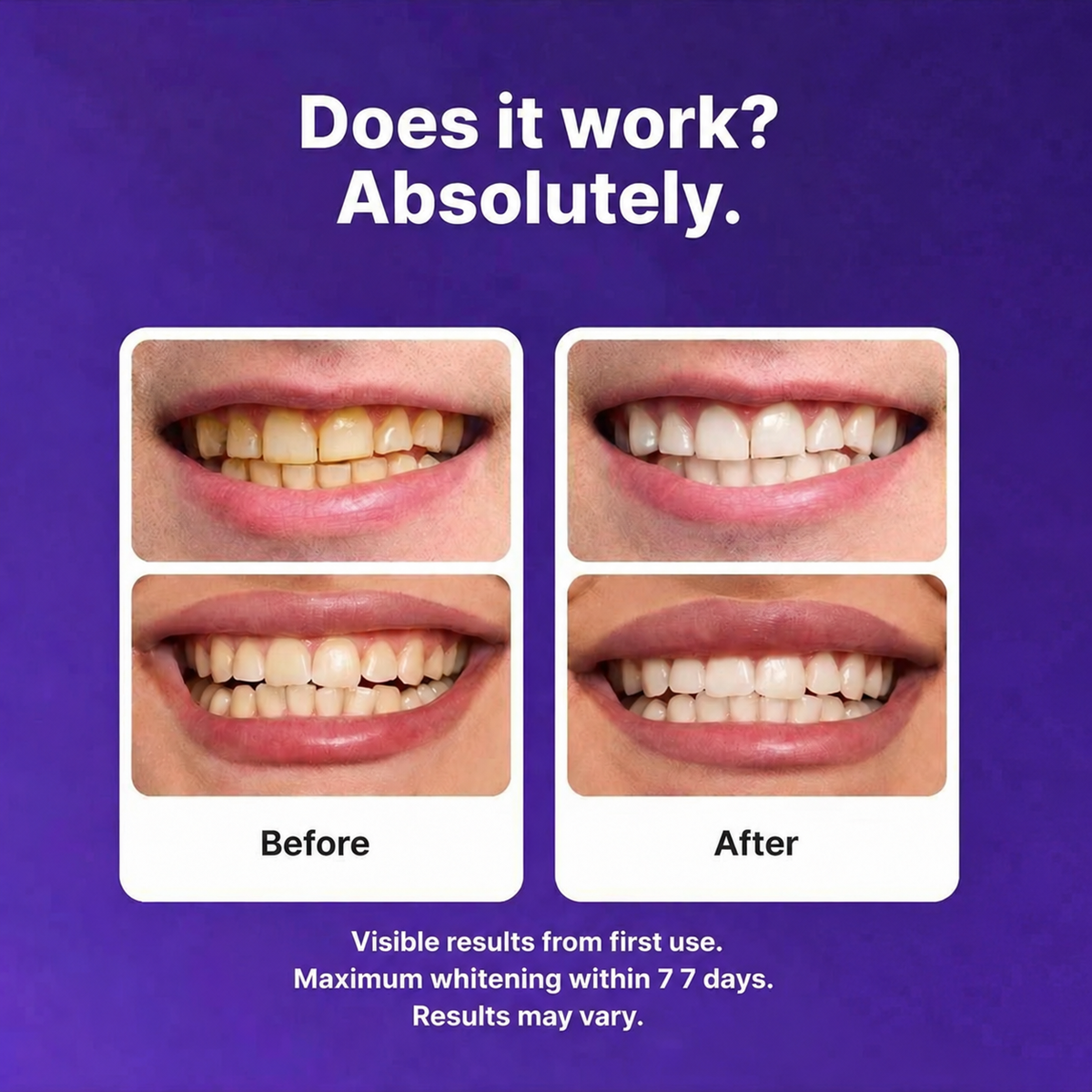 Purple Teeth Whitening Strips